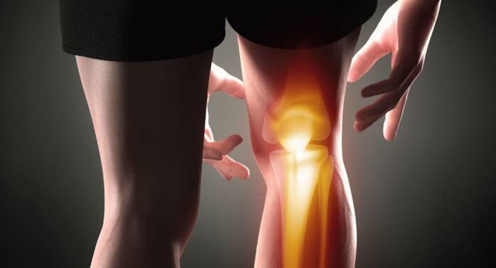 Symptoms of Artrosis