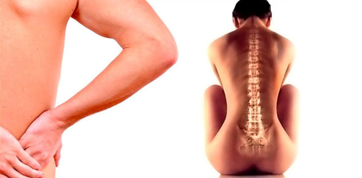 back pain due to osteochondrosis